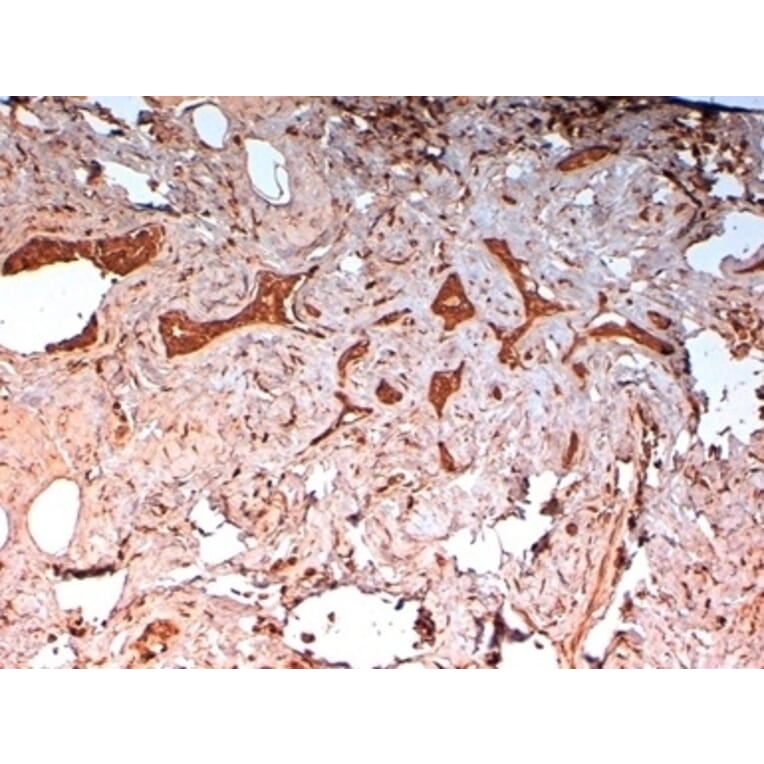 Immunohistochemistry - Anti-Cytokeratin 14 Antibody [LL002] (A280878) - Antibodies.com