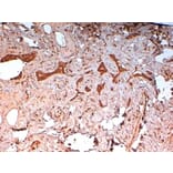 Immunohistochemistry - Anti-Cytokeratin 14 Antibody [LL002] (A280878) - Antibodies.com