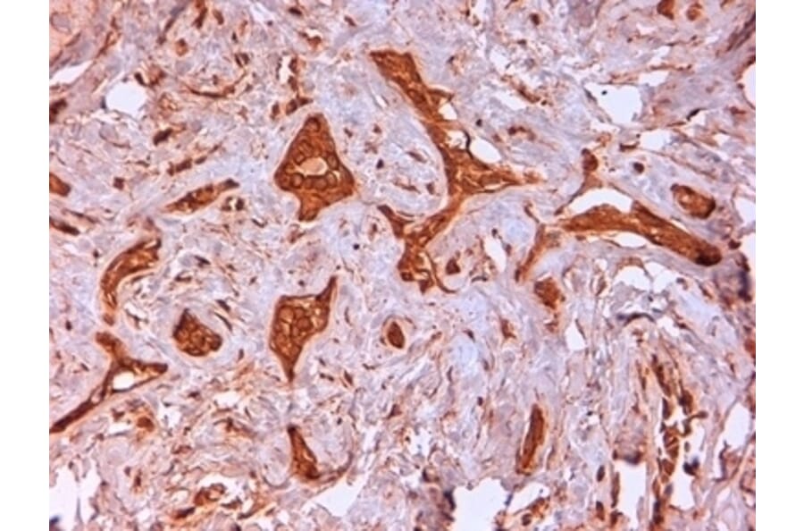 Immunohistochemistry - Anti-Cytokeratin 14 Antibody [LL002] (A280878) - Antibodies.com