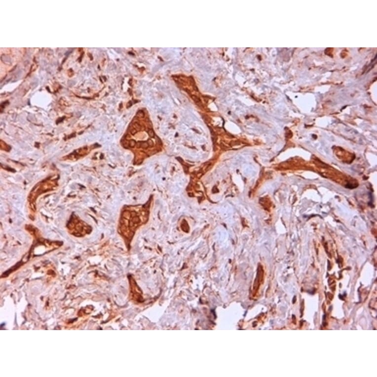 Immunohistochemistry - Anti-Cytokeratin 14 Antibody [LL002] (A280878) - Antibodies.com