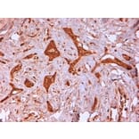 Immunohistochemistry - Anti-Cytokeratin 14 Antibody [LL002] (A280878) - Antibodies.com
