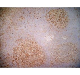 Immunohistochemistry - Anti-CD40 Antibody [LOB7/6] (A280900) - Antibodies.com