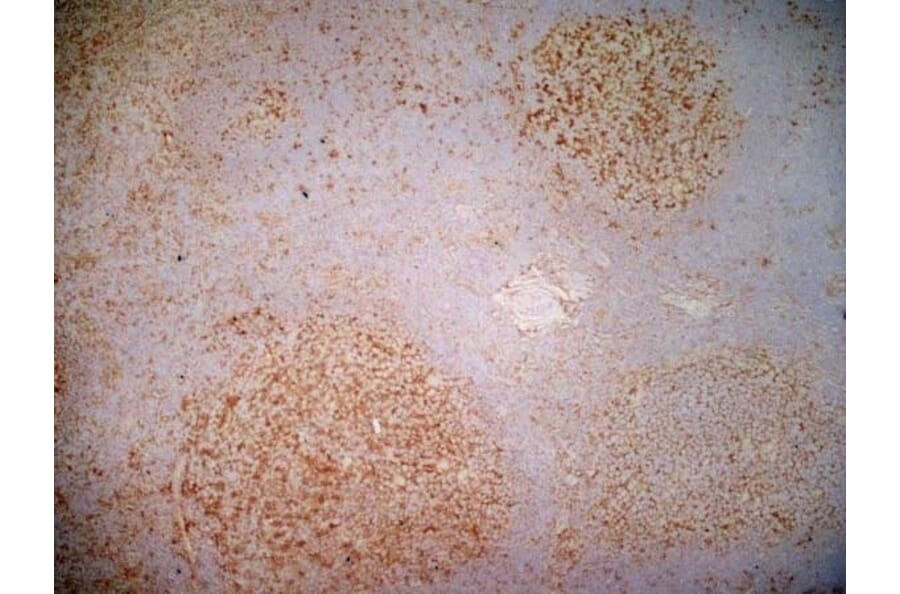 Immunohistochemistry - Anti-CD40 Antibody [LOB7/6] (A280900) - Antibodies.com