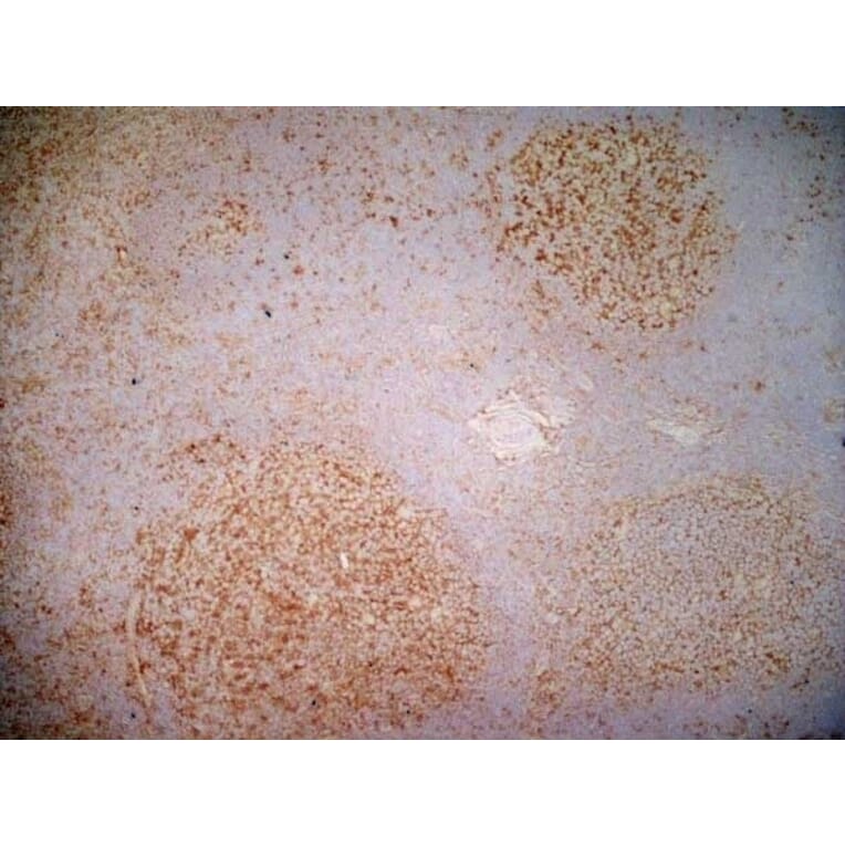 Immunohistochemistry - Anti-CD40 Antibody [LOB7/6] (A280900) - Antibodies.com