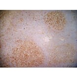 Immunohistochemistry - Anti-CD40 Antibody [LOB7/6] (A280900) - Antibodies.com