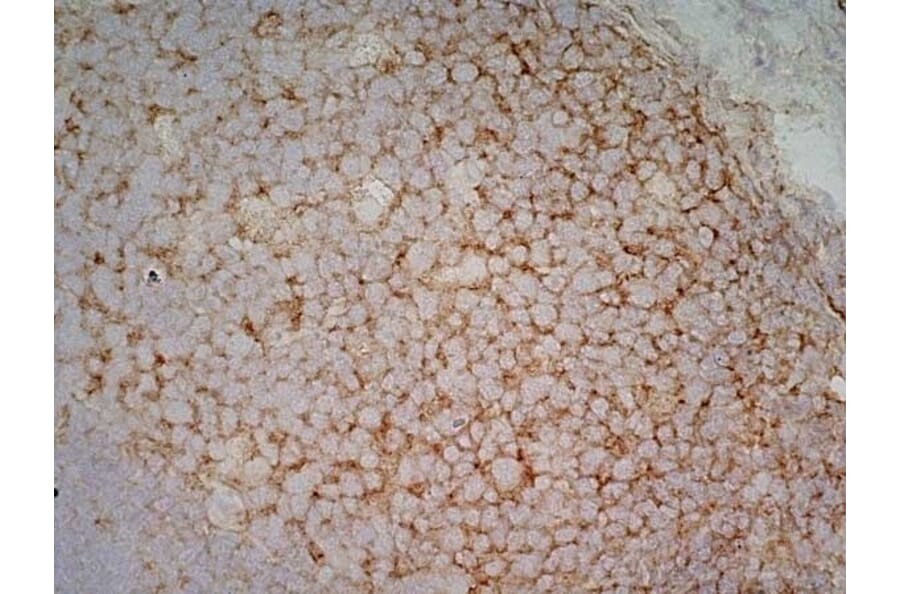 Immunohistochemistry - Anti-CD40 Antibody [LOB7/6] (A280900) - Antibodies.com