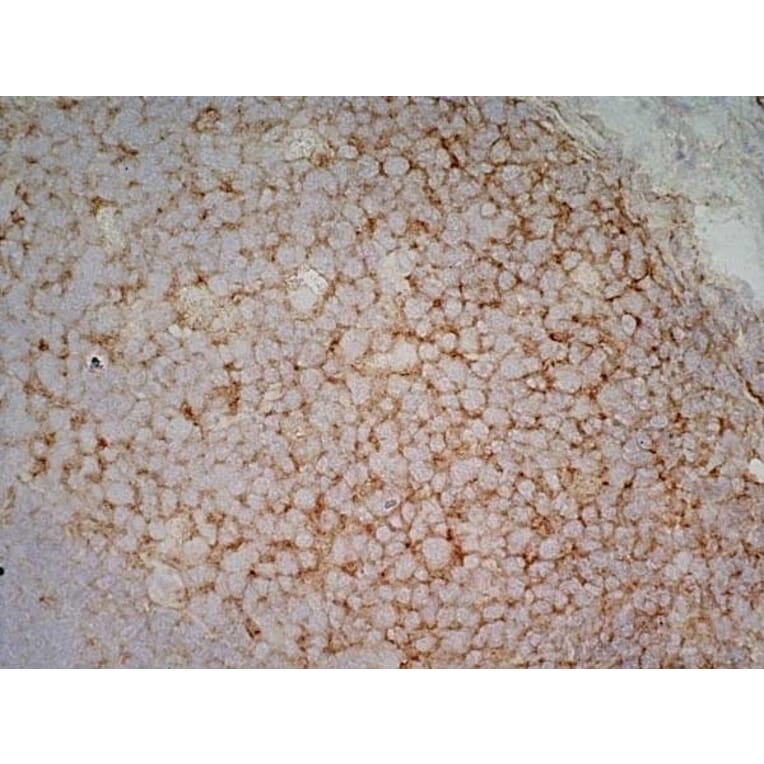 Immunohistochemistry - Anti-CD40 Antibody [LOB7/6] (A280900) - Antibodies.com