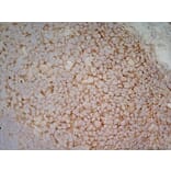 Immunohistochemistry - Anti-CD40 Antibody [LOB7/6] (A280900) - Antibodies.com