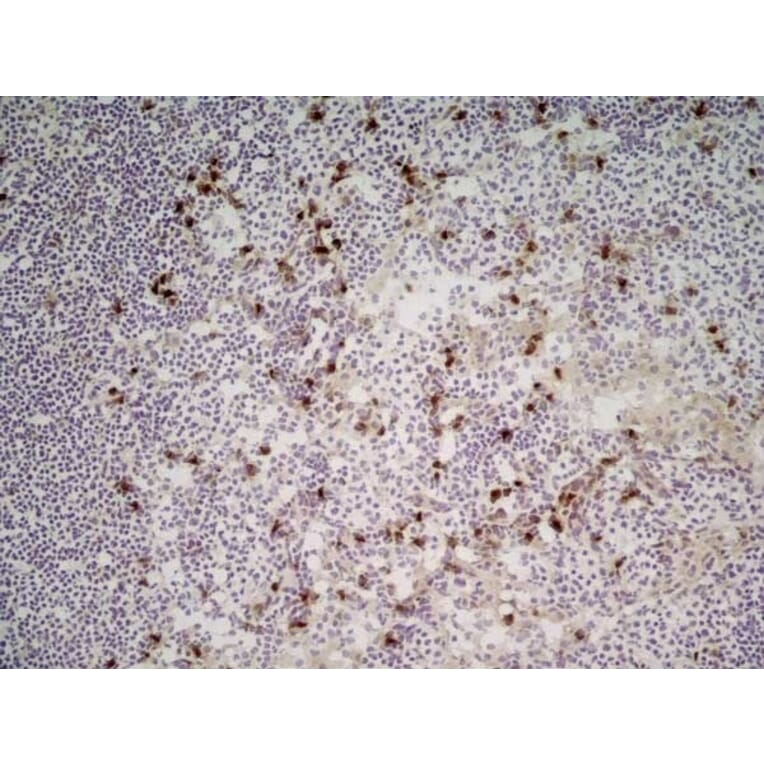 Immunohistochemistry - Anti-CD11b Antibody [M1/70.15] (A280992) - Antibodies.com