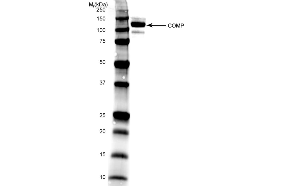 Western Blot - Anti-COMP / Cartilage Oligomeric Matrix Protein Antibody [MA37C94 (HC484D1)] (A281010) - Antibodies.com