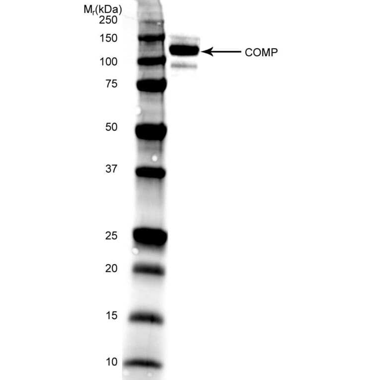 Western Blot - Anti-COMP / Cartilage Oligomeric Matrix Protein Antibody [MA37C94 (HC484D1)] (A281010) - Antibodies.com