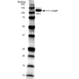 Western Blot - Anti-COMP / Cartilage Oligomeric Matrix Protein Antibody [MA37C94 (HC484D1)] (A281010) - Antibodies.com