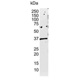 Western Blot - Anti-HLA E Antibody [MEM-E/02] (A281173) - Antibodies.com