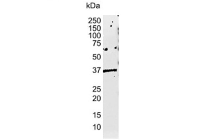 Western Blot - Anti-HLA E Antibody [MEM-E/02] (A281173) - Antibodies.com