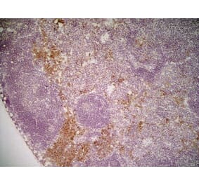 Immunohistochemistry - Anti-Mannose Receptor Antibody [MR5D3] (A281282) - Antibodies.com
