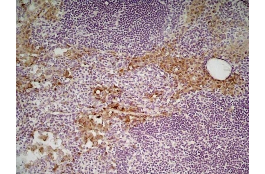Immunohistochemistry - Anti-Mannose Receptor Antibody [MR5D3] (A281282) - Antibodies.com