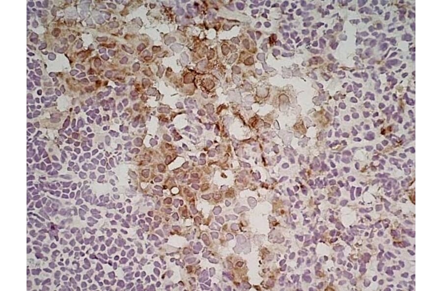 Immunohistochemistry - Anti-Mannose Receptor Antibody [MR5D3] (A281282) - Antibodies.com