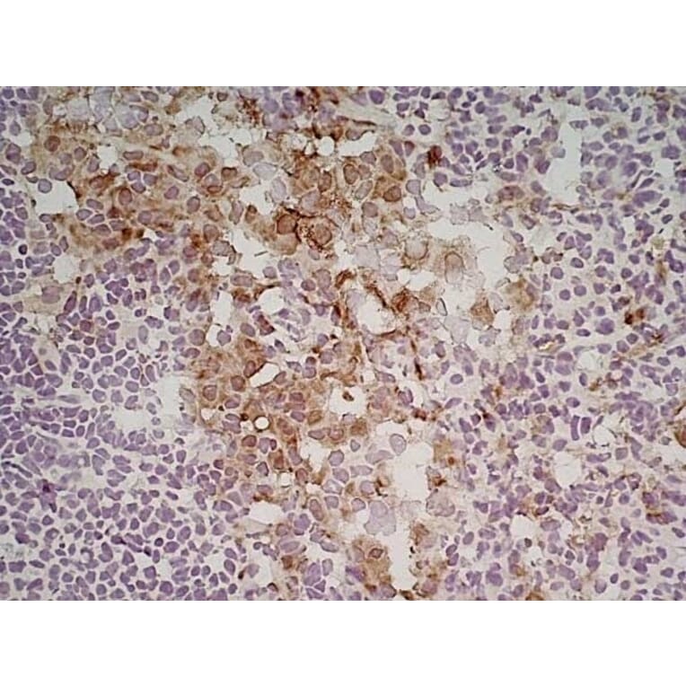 Immunohistochemistry - Anti-Mannose Receptor Antibody [MR5D3] (A281282) - Antibodies.com