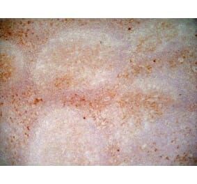 Immunohistochemistry - Anti-CD1a Antibody [NA1/34-HLK] (A281314) - Antibodies.com