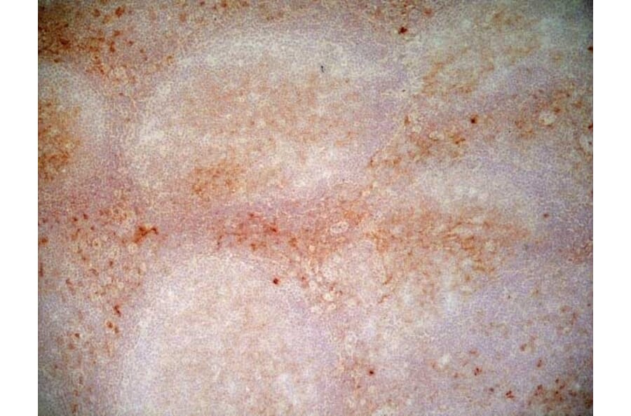 Immunohistochemistry - Anti-CD1a Antibody [NA1/34-HLK] (A281314) - Antibodies.com