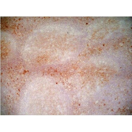 Immunohistochemistry - Anti-CD1a Antibody [NA1/34-HLK] (A281314) - Antibodies.com