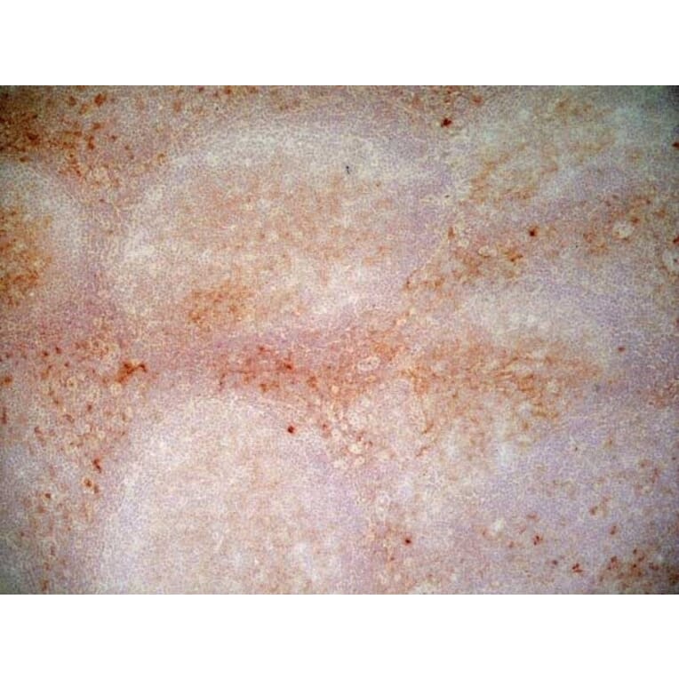 Immunohistochemistry - Anti-CD1a Antibody [NA1/34-HLK] (A281314) - Antibodies.com