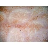 Immunohistochemistry - Anti-CD1a Antibody [NA1/34-HLK] (A281314) - Antibodies.com