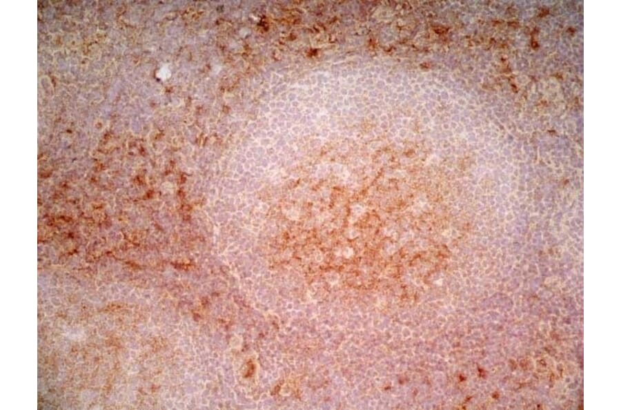 Immunohistochemistry - Anti-CD1a Antibody [NA1/34-HLK] (A281314) - Antibodies.com