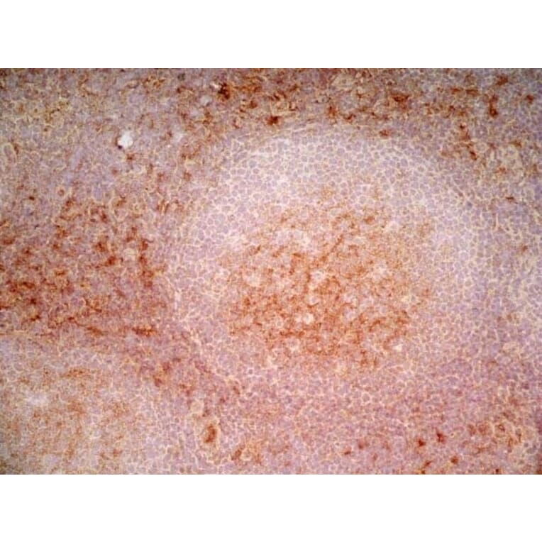 Immunohistochemistry - Anti-CD1a Antibody [NA1/34-HLK] (A281314) - Antibodies.com