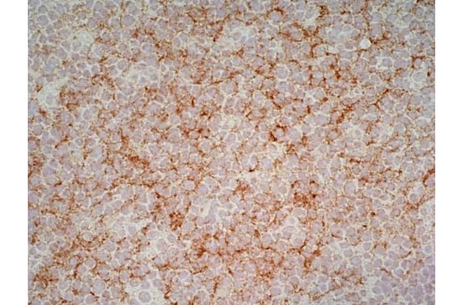Immunohistochemistry - Anti-CD1a Antibody [NA1/34-HLK] (A281314) - Antibodies.com