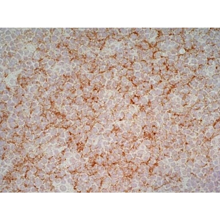 Immunohistochemistry - Anti-CD1a Antibody [NA1/34-HLK] (A281314) - Antibodies.com