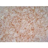 Immunohistochemistry - Anti-CD1a Antibody [NA1/34-HLK] (A281314) - Antibodies.com