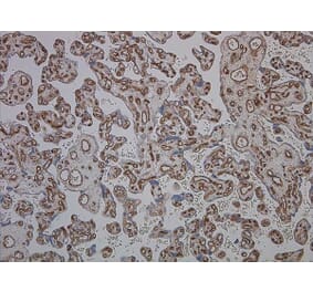 Immunohistochemistry - Anti-CD34 Antibody [QBEND/10] (A281617) - Antibodies.com