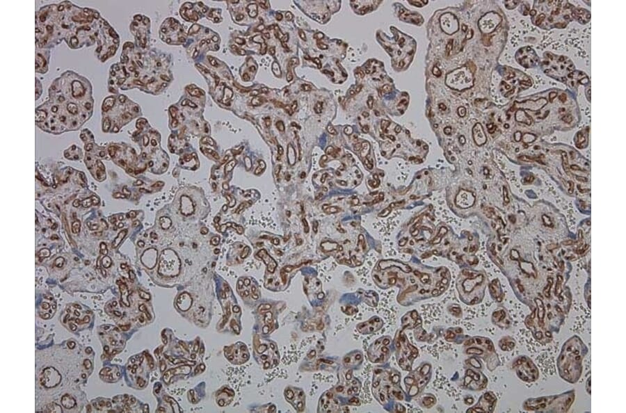 Immunohistochemistry - Anti-CD34 Antibody [QBEND/10] (A281617) - Antibodies.com