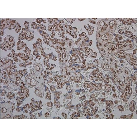 Immunohistochemistry - Anti-CD34 Antibody [QBEND/10] (A281617) - Antibodies.com