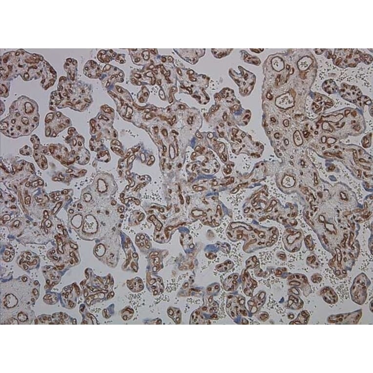 Immunohistochemistry - Anti-CD34 Antibody [QBEND/10] (A281617) - Antibodies.com