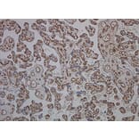 Immunohistochemistry - Anti-CD34 Antibody [QBEND/10] (A281617) - Antibodies.com
