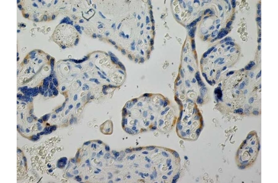 Immunohistochemistry - Anti-Inhibin alpha Antibody [R1] (A281621) - Antibodies.com
