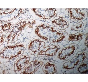 Immunohistochemistry - Anti-Inhibin alpha Antibody [R1] (A281621) - Antibodies.com