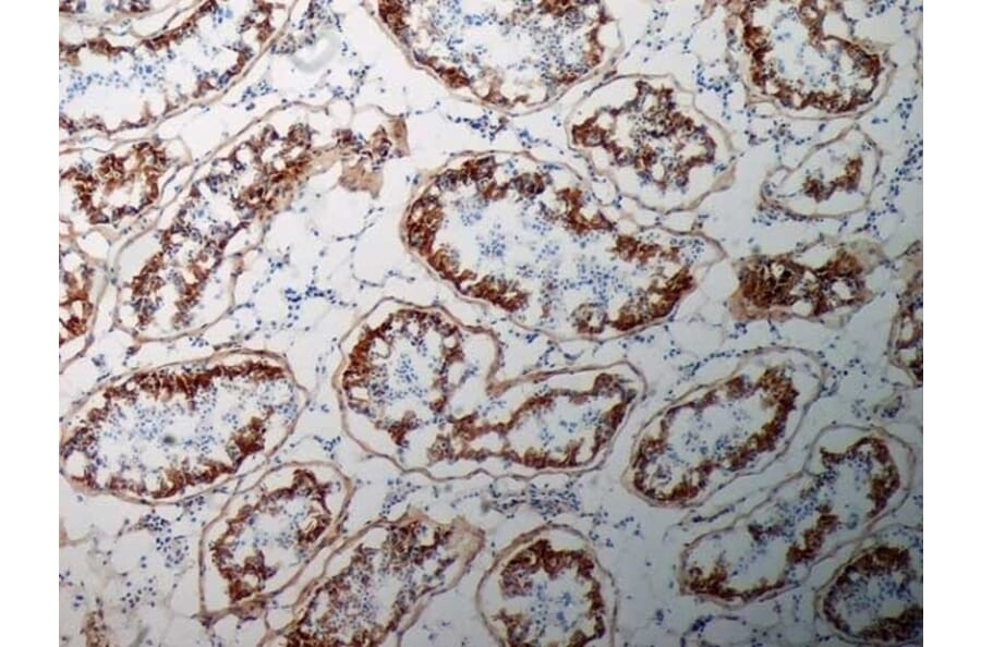 Immunohistochemistry - Anti-Inhibin alpha Antibody [R1] (A281621) - Antibodies.com