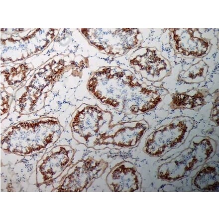 Immunohistochemistry - Anti-Inhibin alpha Antibody [R1] (A281621) - Antibodies.com