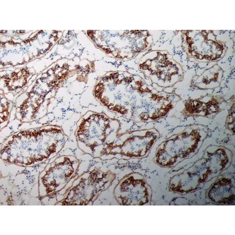 Immunohistochemistry - Anti-Inhibin alpha Antibody [R1] (A281621) - Antibodies.com