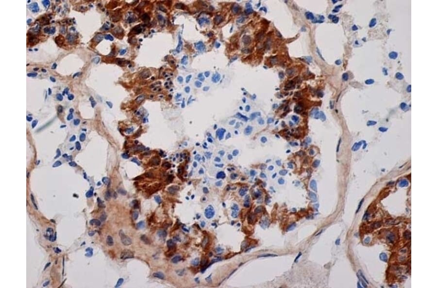 Immunohistochemistry - Anti-Inhibin alpha Antibody [R1] (A281621) - Antibodies.com