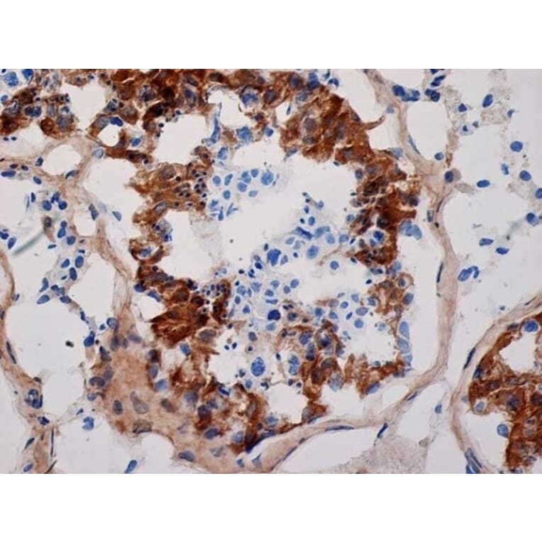 Immunohistochemistry - Anti-Inhibin alpha Antibody [R1] (A281621) - Antibodies.com