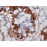 Immunohistochemistry - Anti-Inhibin alpha Antibody [R1] (A281621) - Antibodies.com