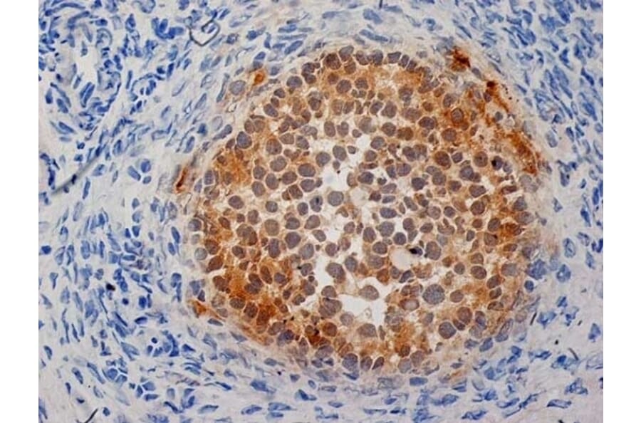 Immunohistochemistry - Anti-Inhibin alpha Antibody [R1] (A281621) - Antibodies.com