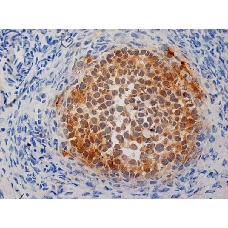 Immunohistochemistry - Anti-Inhibin alpha Antibody [R1] (A281621) - Antibodies.com