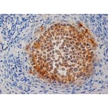Immunohistochemistry - Anti-Inhibin alpha Antibody [R1] (A281621) - Antibodies.com