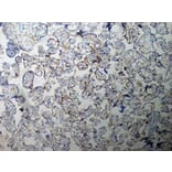 Immunohistochemistry - Anti-Inhibin alpha Antibody [R1] (A281621) - Antibodies.com