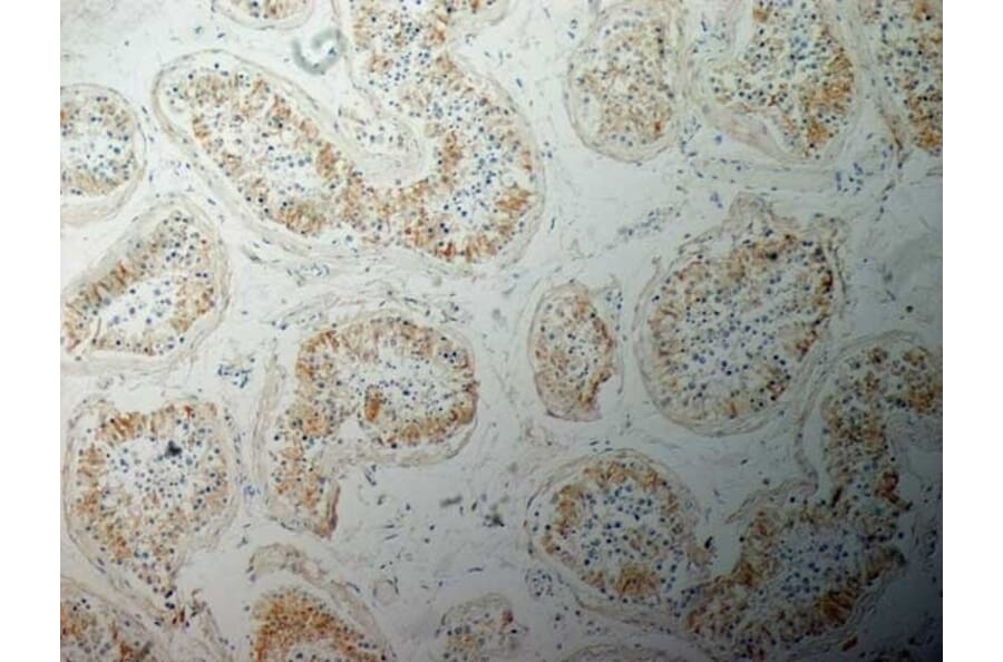 Immunohistochemistry - Anti-Inhibin alpha Antibody [R1] (A281621) - Antibodies.com